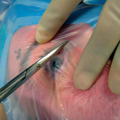Хирургическое офтальмического Molder Formable устранимое стерильное задрапировывает с держателем кабеля