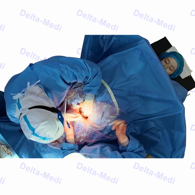 Стерильный хирургический раздел c задрапировывает с Gynecology Obsterics фенестрации задрапировывает пакет
